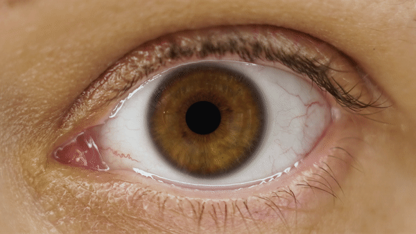 A eye with a dilating pupil