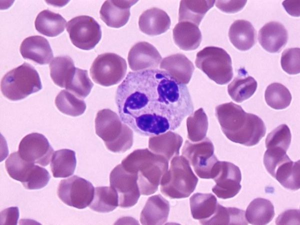 Mikroskopbilde av Segmentkjernet granulocytt, blodplater og røde blodceller