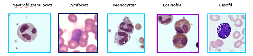 Blodcellenes morfologi