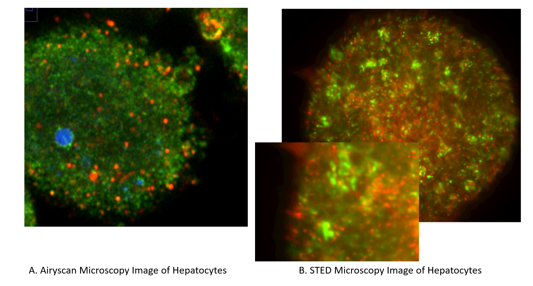 immune-fuorescence image of hepatocytes